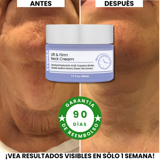 Crema Lifting de Cuello Evonex®